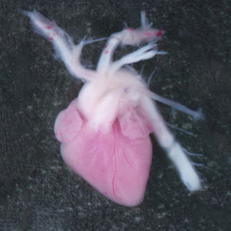 Human fetal heart 12 weeks post conception